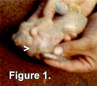 Squab with leg grown in navel.